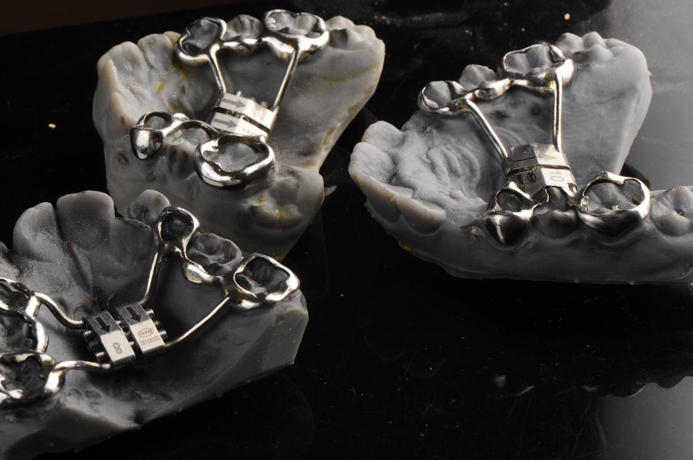 Palatal Expander