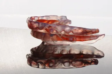 Mandibular Advancement Appliance