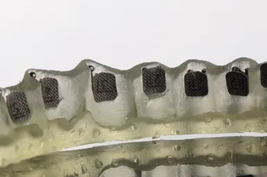 Indirect Bracket Bonding Tray