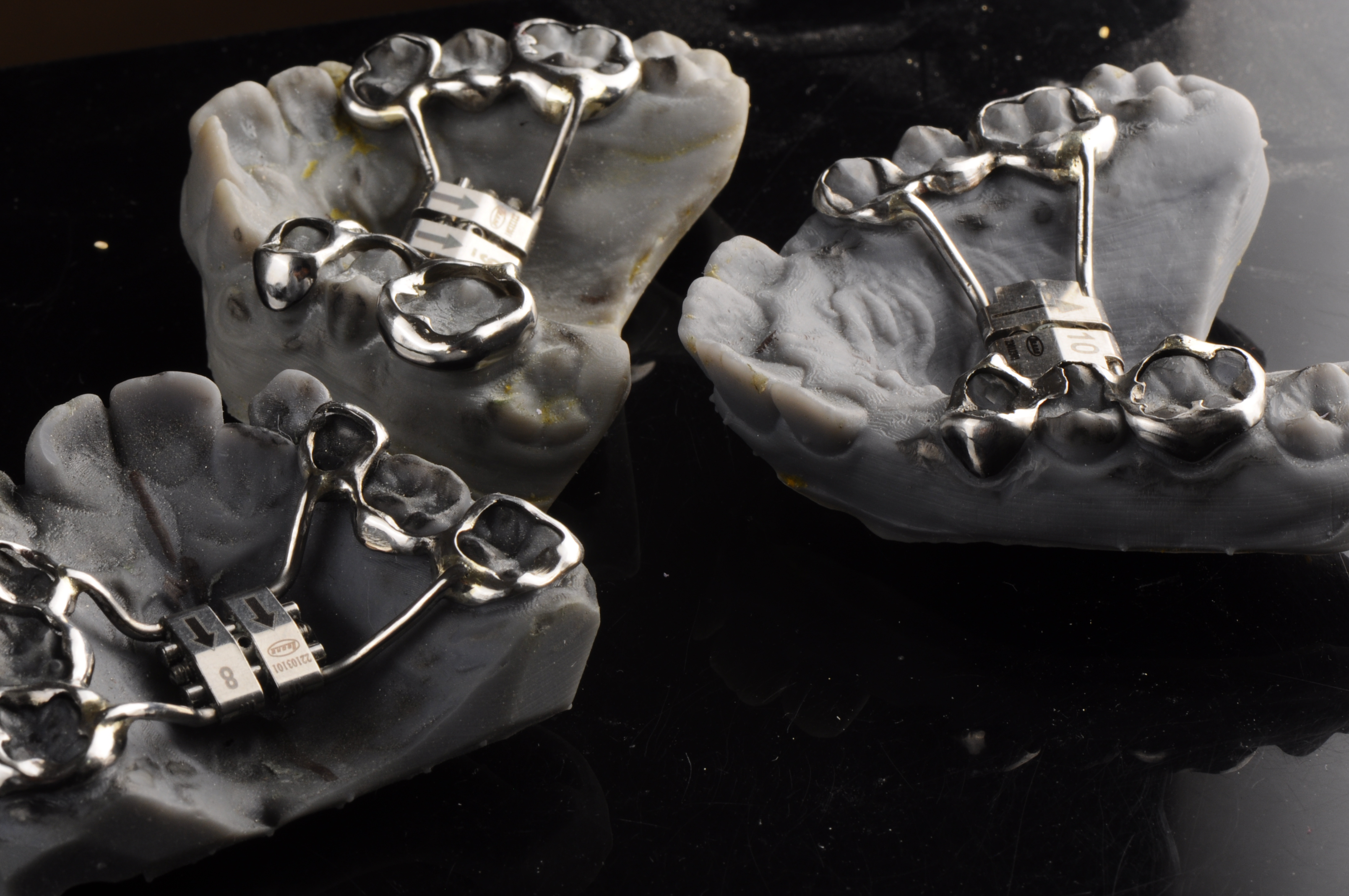 Palatal Expander