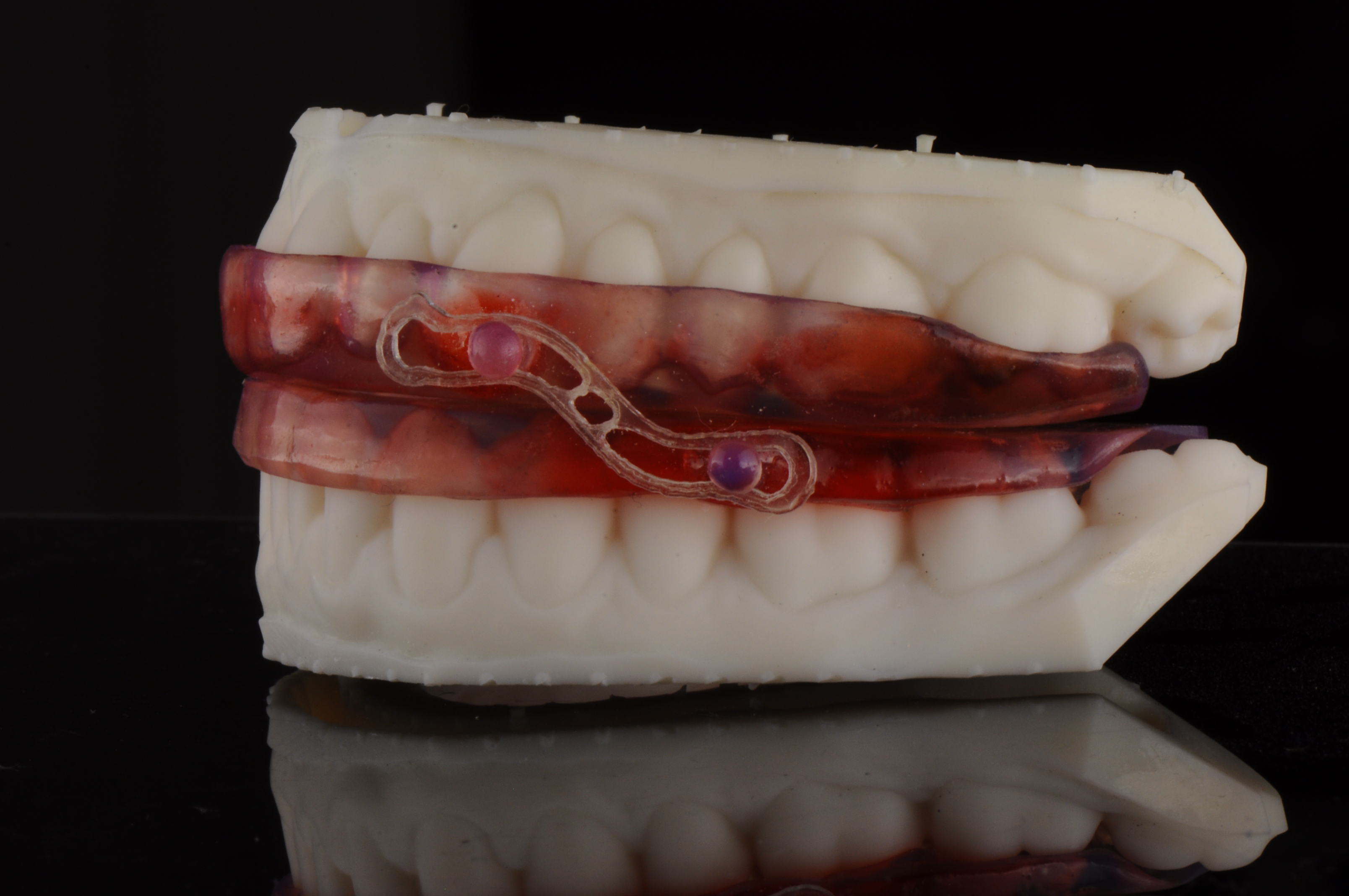 apnea Appliance