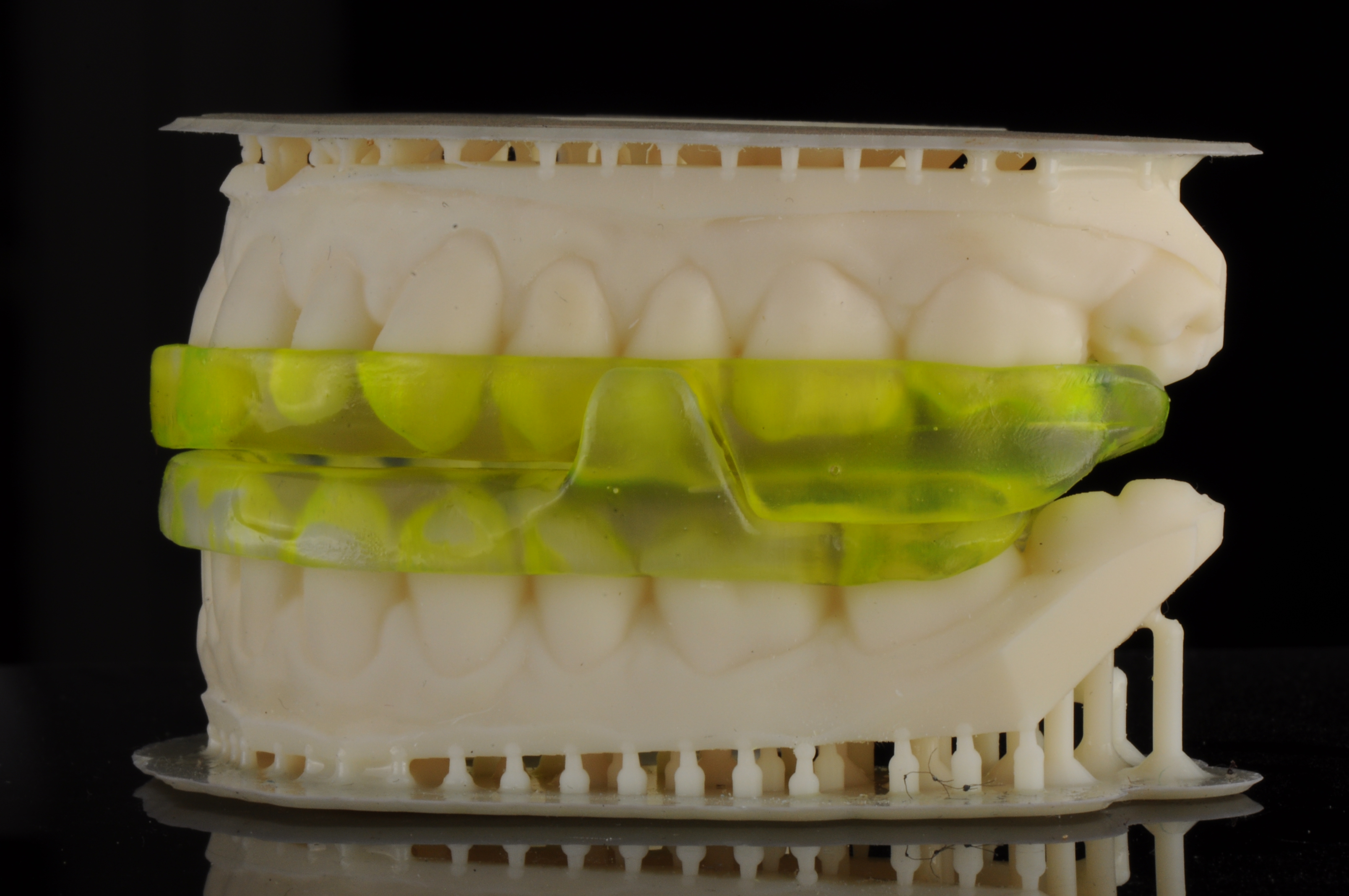 apnea Appliance