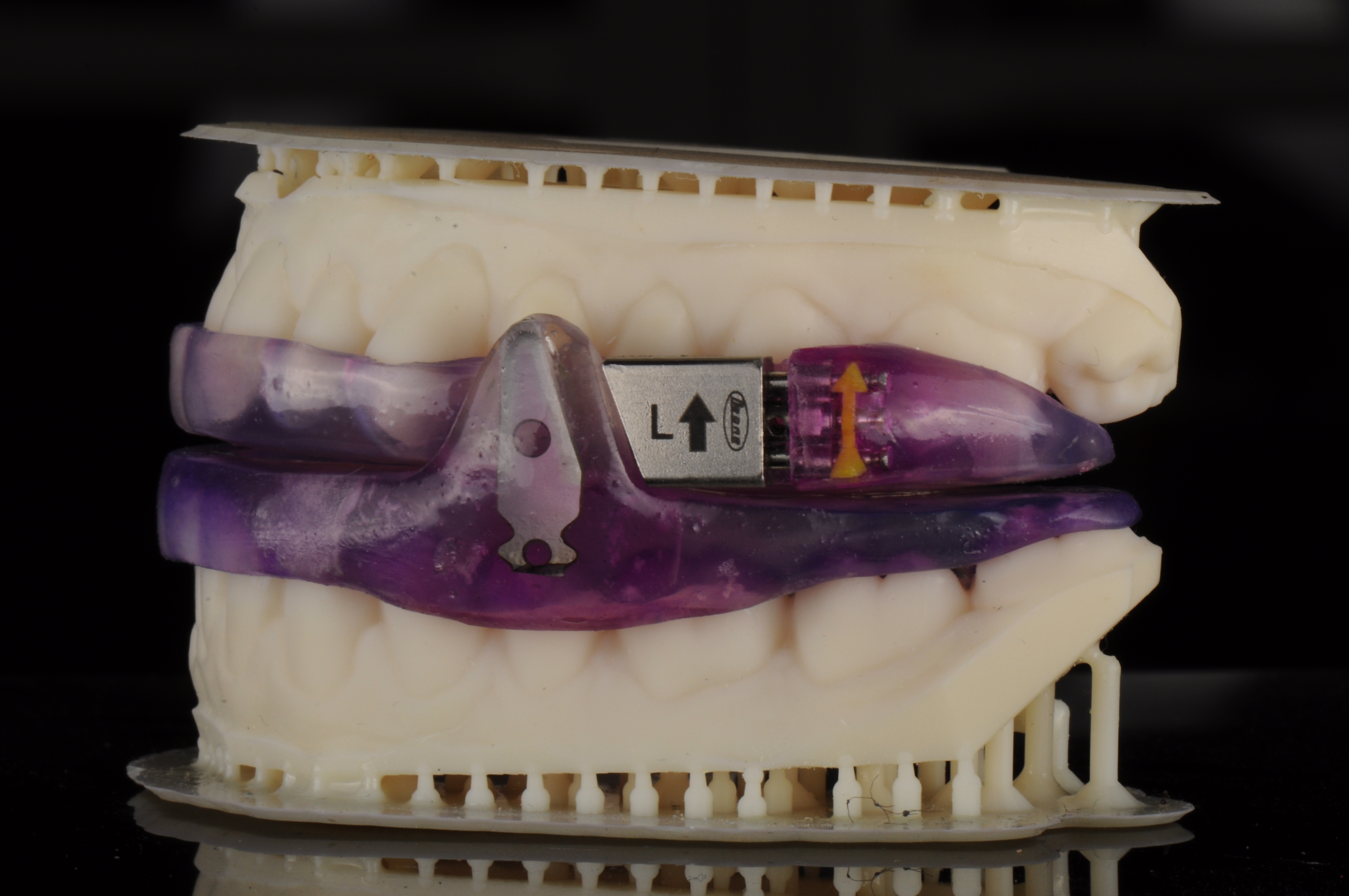 apnea Appliance