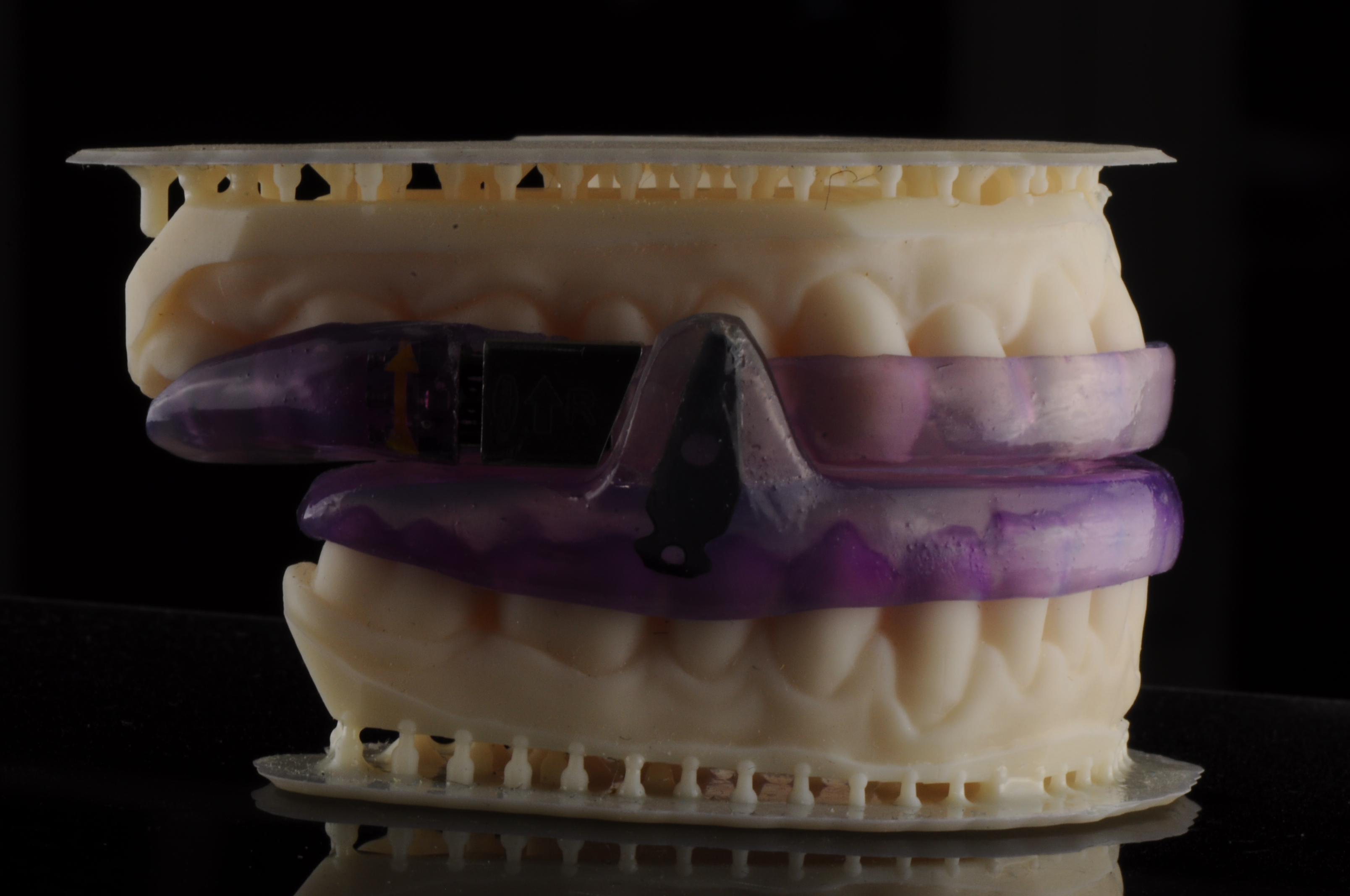 apnea Appliance