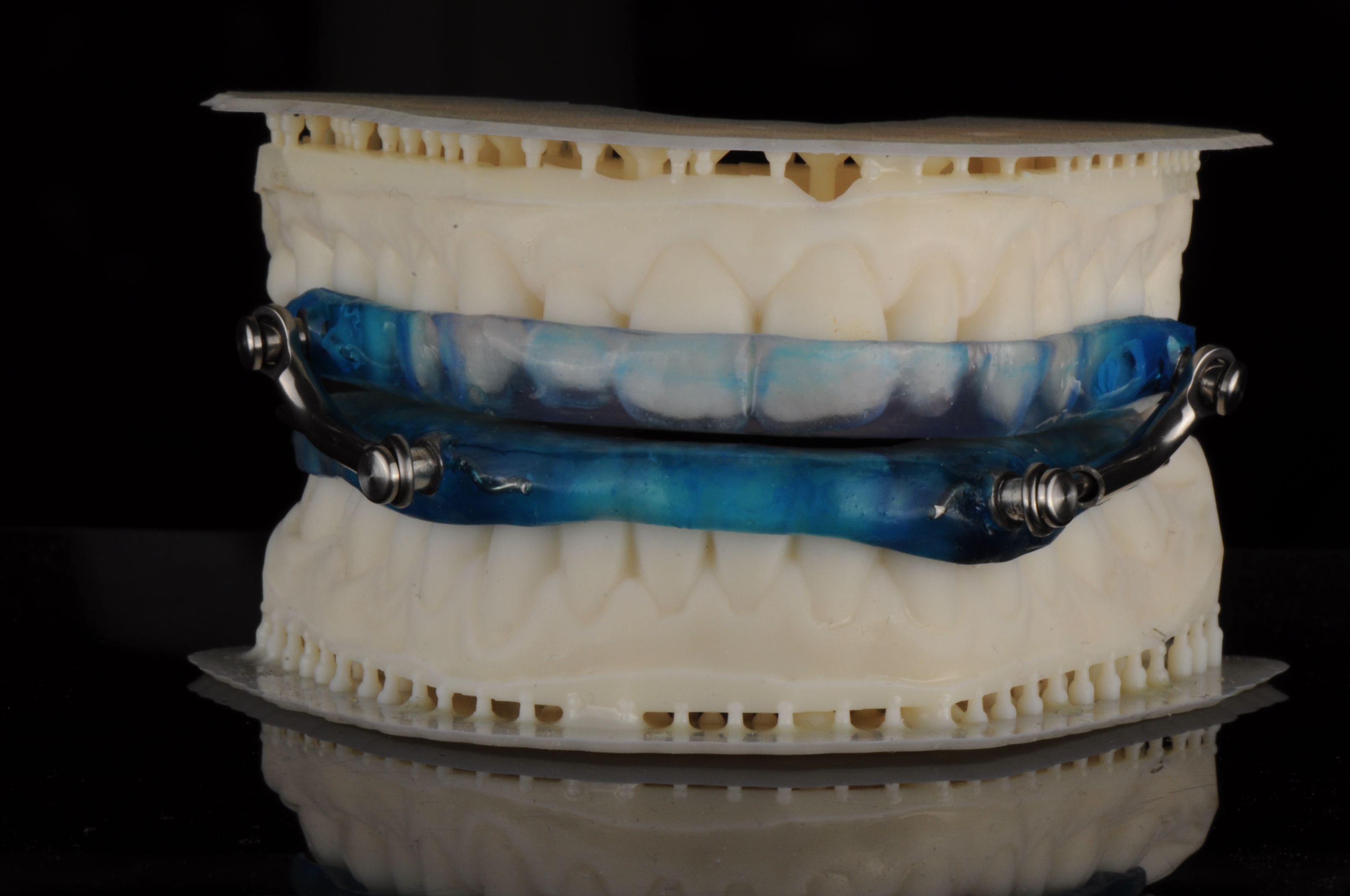apnea Appliance