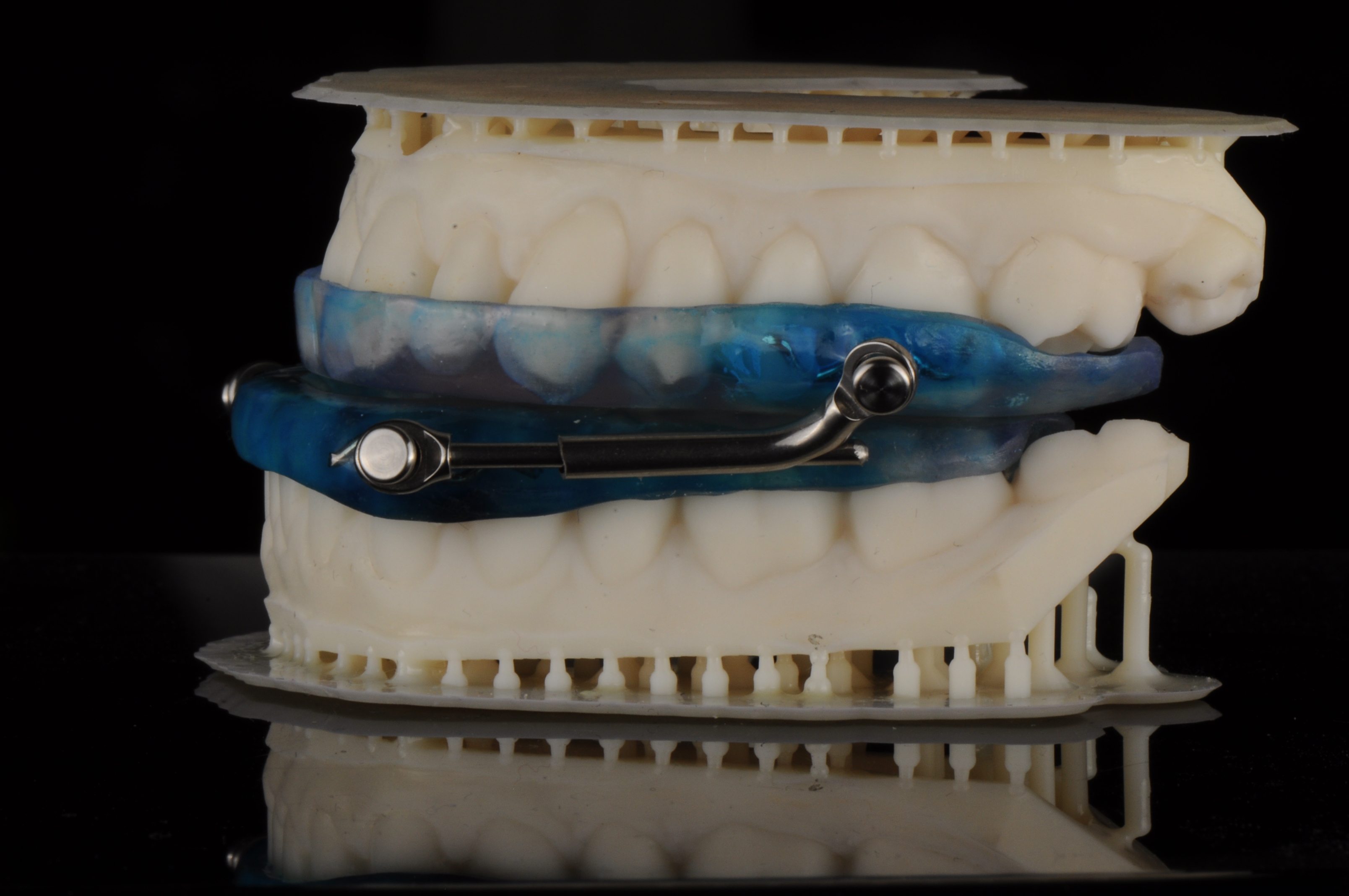 apnea Appliance