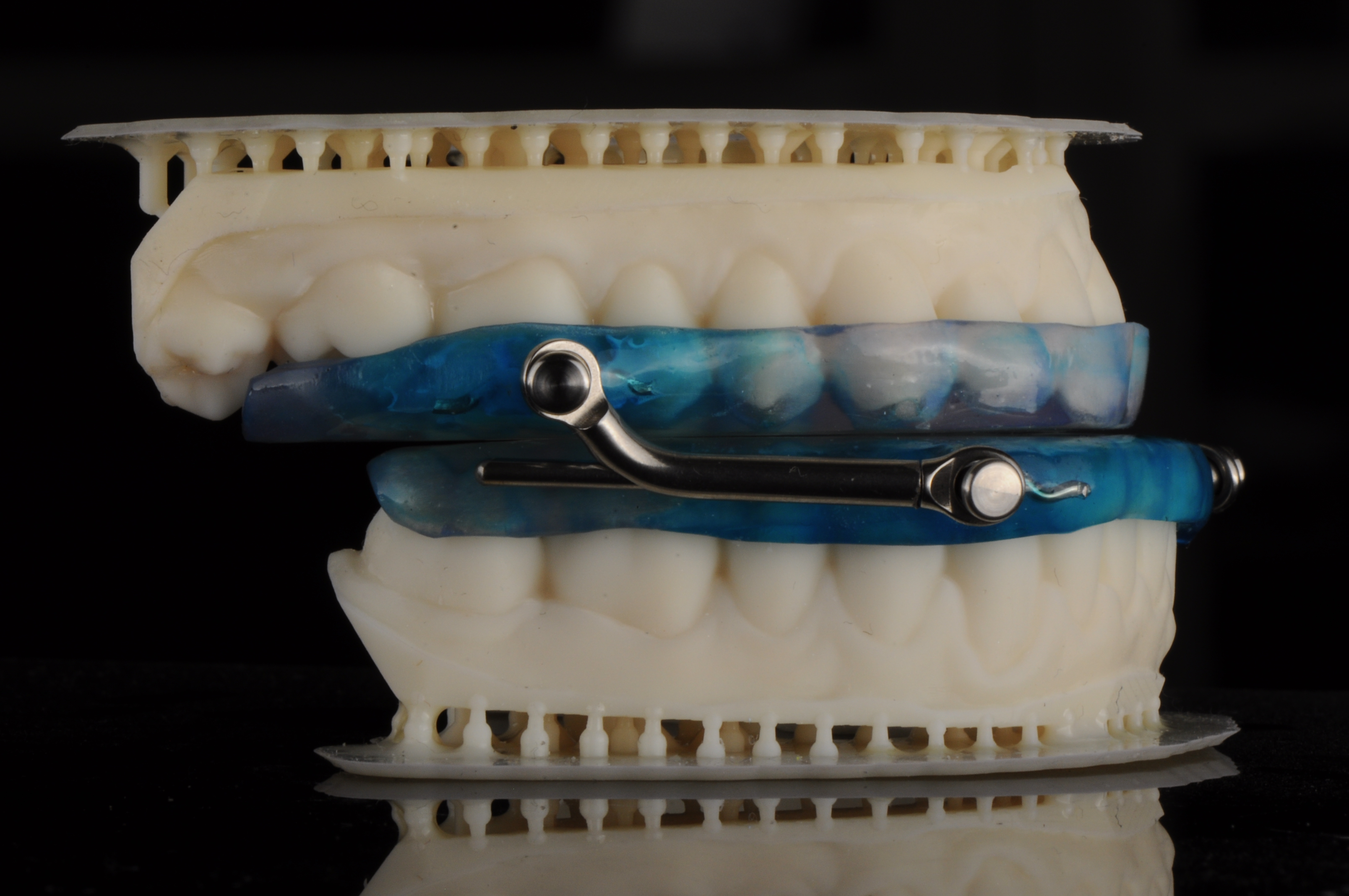 apnea Appliance