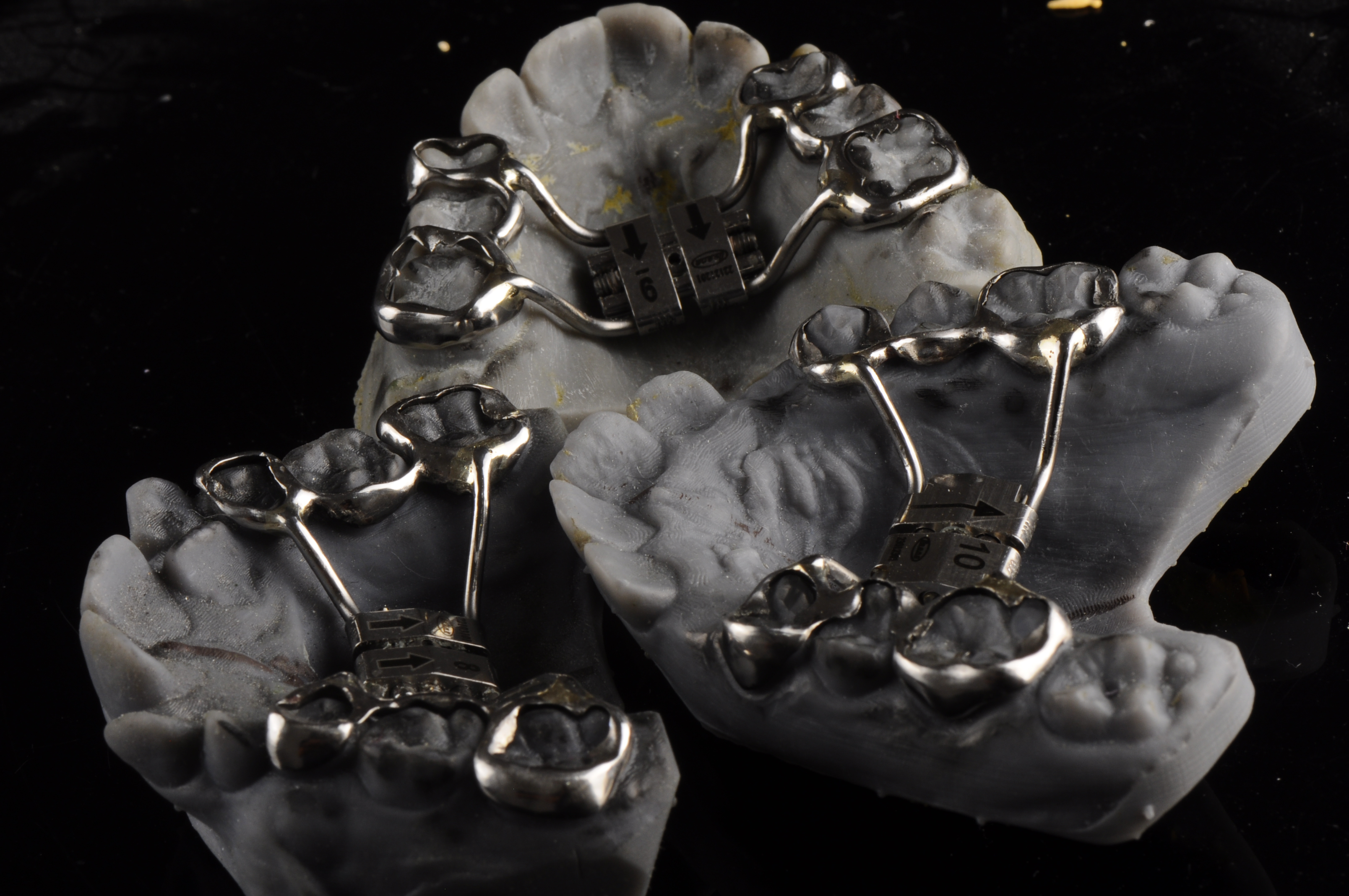 palatal expander