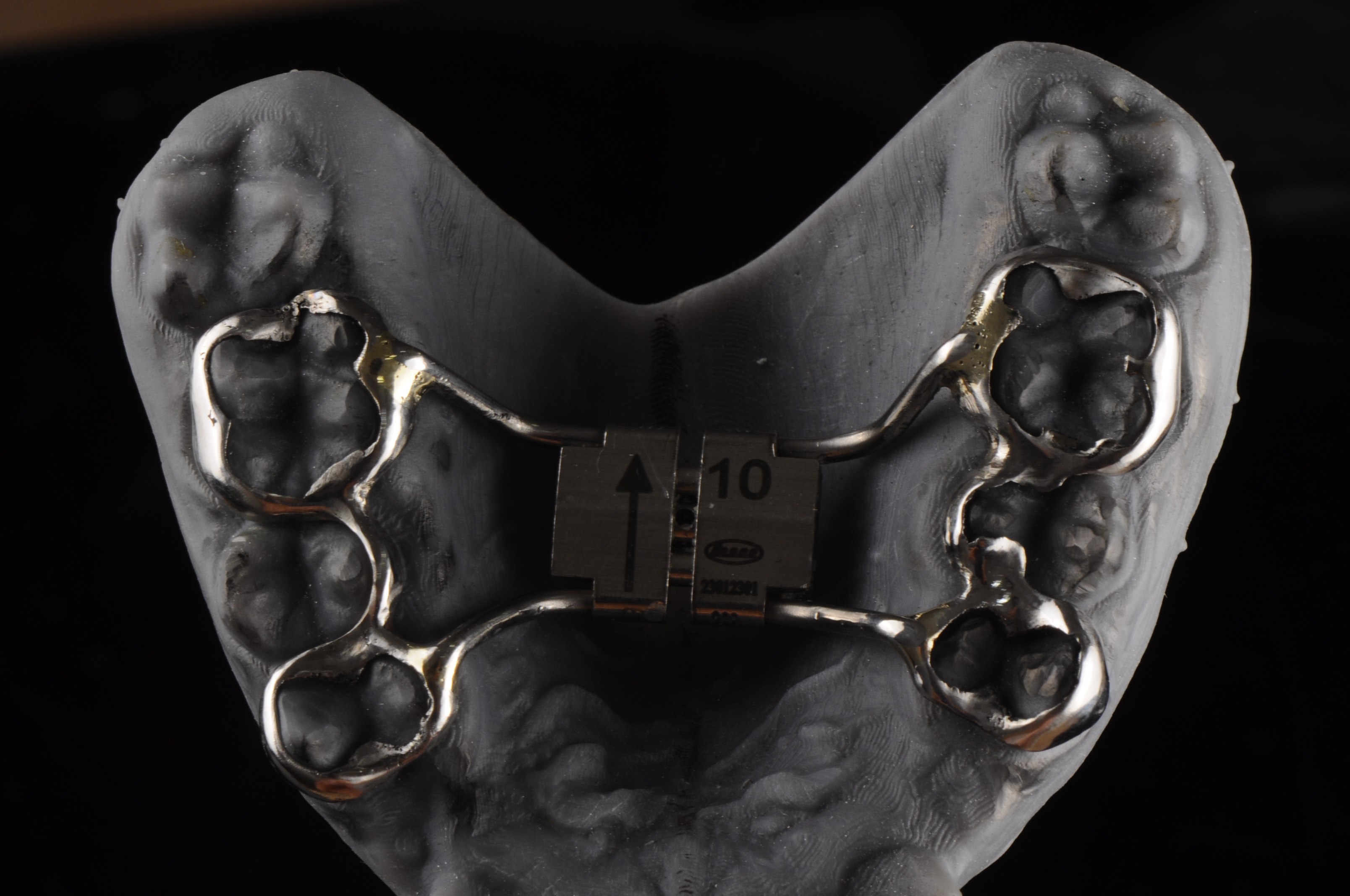 palatal expander